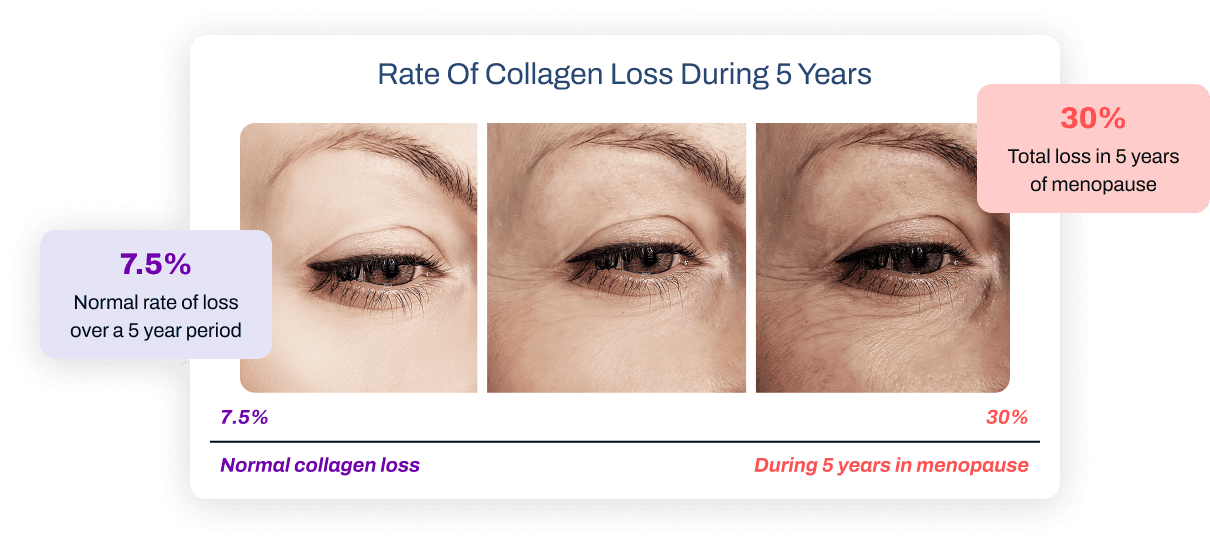 Collagen loss rate.