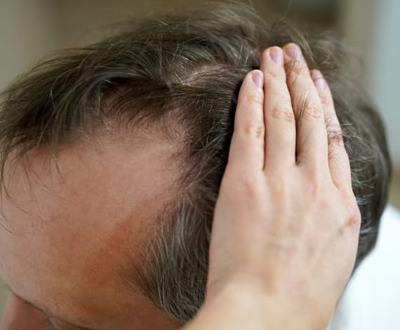 Man with healthy hair.